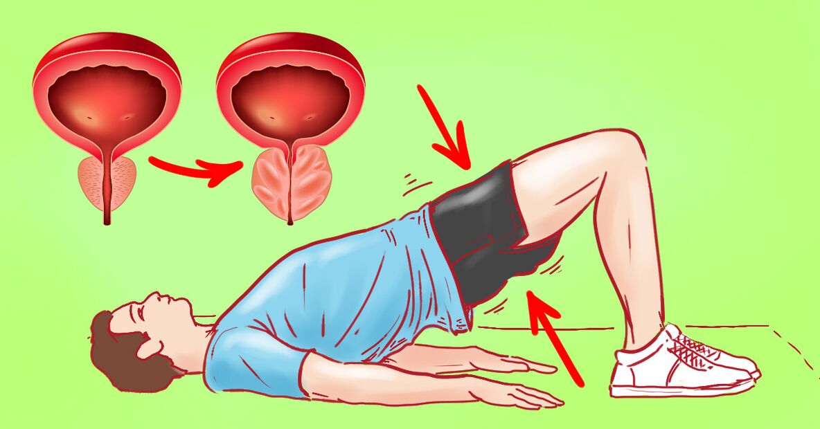ćwiczenia gimnastyczne na zapalenie prostaty